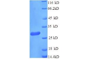 SDS-PAGE (SDS) image for CD163 (CD163) (AA 86-365), (partial) protein (His tag) (ABIN5711361) (CD163 Protein (CD163) (AA 86-365, partial) (His tag))