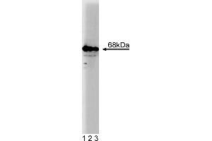 Western Blotting (WB) image for anti-GTPase Activating Protein (SH3 Domain) Binding Protein 1 (G3BP1) (AA 210-323) antibody (ABIN968381) (G3BP1 anticorps  (AA 210-323))