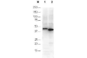 Anti-6X His epitope tag polyclonal antibody detects His-tagged recombinant proteins by western blot. (His Tag anticorps)
