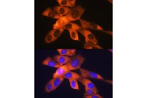 Immunofluorescence analysis of NIH-3T3 cells using RPS19 Rabbit mAb (ABIN1681275, ABIN3017969, ABIN3017970 and ABIN7101552) at dilution of 1:100 (40x lens).