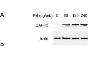 PB triggered cell apoptosis involves elevation of reactive oxygen species (ROS) and accumulation of ER stress. (DAPK3 anticorps  (N-Term))