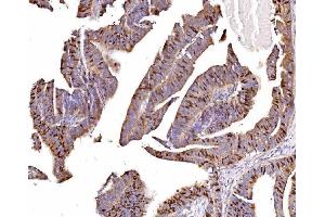 IHC analysis of Geminin/GMNN using anti-Geminin/GMNN antibody (ABIN7600598). (Geminin anticorps  (AA 21-196))
