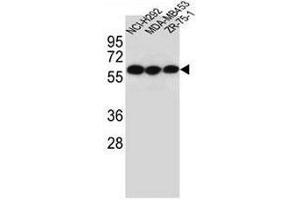 CHRNA10 Antibody (Center) western blot analysis in NCI-H292,MDA-MB453,ZR-75-1 cell line lysates (35µg/lane). (CHRNA10 anticorps  (Middle Region))