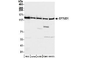 anti-Elongation Factor Tu GTP Binding Domain Containing 1 (EFTUD1) (AA 700-750) antibody