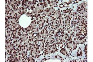 Image no. 7 for anti-Dynamin 1-Like (DNM1L) antibody (ABIN1497871)