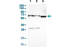 Western Blot analysis of (1) human cell line RT-4 (2) human cell line U-251MG sp, and (3) human plasma (IgG/HSA depleted). (EIF2AK1 anticorps  (AA 34-180))