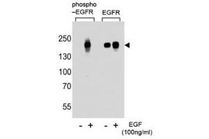 Western blot analysis of lysate from A431 cells (left to right), untreated or treated with EGF at 100ng/ml, using phospho-EGFR antibody (pS768) or nonphos Ab at 1:1000 dilution.