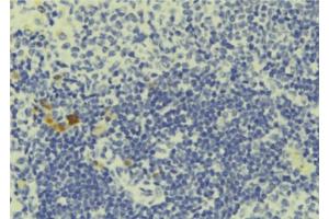 ABIN6277704 at 1/100 staining Human lymph tissue by IHC-P. (PCM1 anticorps  (N-Term))