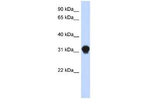 WB Suggested Anti-DNALI1 Antibody Titration: 0. (DNALI1 anticorps  (N-Term))