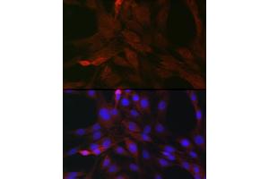 Immunofluorescence analysis of C6 cells using SOCS3 Rabbit pAb (ABIN3021099, ABIN3021100, ABIN3021101 and ABIN6213950) at dilution of 1:50 (40x lens).
