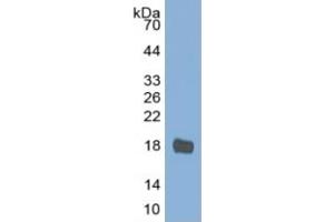 Mouse Capture antibody from the kit in WB with Positive Control: Sample Human Stomach lysate.