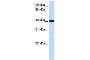 WB Suggested Anti-TMOD3 Antibody Titration: 0. (TMOD3 anticorps  (N-Term))