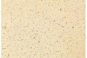 ABIN6265962 and ABIN6269219 at 1/100 staining Mouse brain tissue by IHC-P. (Cadherin 5 anticorps  (C-Term))