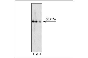 Western blot analysis of RORgammat expression by mouse thymocytes. (ROR gamma T/RORC2/NR1F3 anticorps)