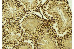 ABIN6274520 at 1/100 staining Mouse testis tissue by IHC-P. (AKIP1 anticorps  (Internal Region))