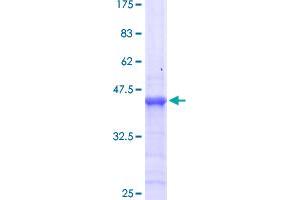 Image no. 1 for Homeobox B13 (HOXB13) (AA 61-216) protein (GST tag) (ABIN1306948)