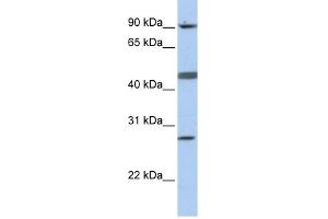 CENPI antibody used at 1 ug/ml to detect target protein.