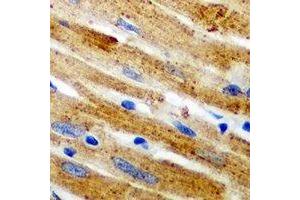 Immunohistochemical analysis of Calpain 1 staining in mouse heart formalin fixed paraffin embedded tissue section. (CAPN1 anticorps)