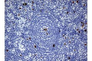 Image no. 7 for anti-Antigen Identified By Monoclonal Antibody Ki-67 (MKI67) (AA 1160-1493) antibody (ABIN1490857) (Ki-67 anticorps  (AA 1160-1493))