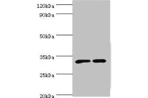 Western blot All lanes: SLC25A15 antibody at 6 μg/mL Lane 1: Mouse liver tissue Lane 2: Mouse stomach tissue Secondary Goat polyclonal to rabbit IgG at 1/10000 dilution Predicted band size: 33 kDa Observed band size: 33 kDa