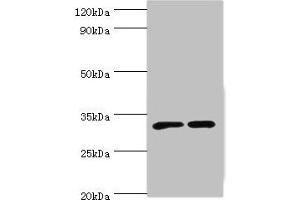 Western blot All lanes: SLC25A15 antibody at 6 μg/mL Lane 1: Mouse liver tissue Lane 2: Mouse stomach tissue Secondary Goat polyclonal to rabbit IgG at 1/10000 dilution Predicted band size: 33 kDa Observed band size: 33 kDa (SLC25A15 anticorps  (AA 1-301))