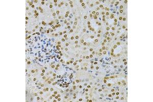 Immunohistochemistry of paraffin-embedded mouse kidney using DKC1 Antibody (ABIN5970956) at dilution of 1/200 (40x lens). (DKC1 anticorps)