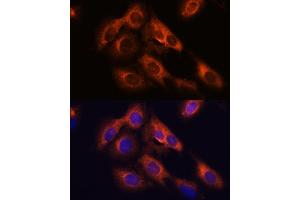 Immunofluorescence analysis of C6 cells using R antibody (ABIN7269856) at dilution of 1:100. (RAPH1 anticorps  (AA 1-240))