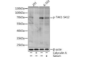 Western blot analysis of extracts of various cell lines, using Phospho-T-S412 Rabbit pAb (ABIN3019511, ABIN3019512, ABIN3019513 and ABIN6225441) at 1:1000 dilution. (MAP3K7 anticorps  (pSer412))