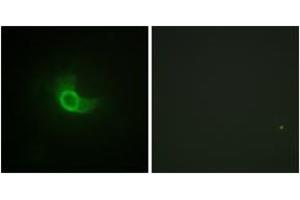 Immunofluorescence analysis of NIH-3T3 cells, using CD130/gp130 (Ab-782) Antibody. (CD130/gp130 anticorps  (AA 748-797))