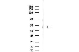 anti-Heparan Sulfate 6-O-Sulfotransferase 1 (HS6ST1) antibody