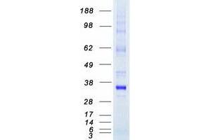 Validation with Western Blot