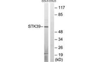 Western blot analysis of extracts from COLO cells, using STK39 (Ab-311) Antibody. (STK39 anticorps  (AA 277-326))