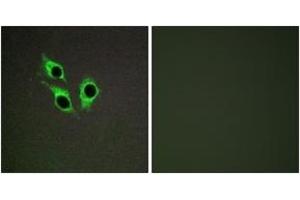 Immunofluorescence analysis of HepG2 cells, using TM16J Antibody. (ANO9 anticorps  (AA 481-530))