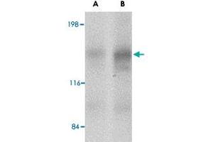 Western blot analysis of CADPS2 in human brain tissue lysate with CADPS2 polyclonal antibody  at (A) 0. (CADPS2 anticorps  (Internal Region))