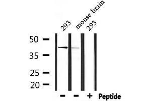 Western blot analysis of extracts from 293 and mouse brain, using ARRDC3 Antibody. (ARRDC3 anticorps  (C-Term))