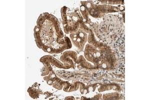 Immunohistochemical staining of human duodenum with FAM129B polyclonal antibody  shows moderate cytoplasmic, nuclear and membranous positivity in glandular cells. (MEG3 anticorps)