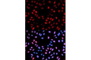 Immunofluorescence analysis of U2OS cells using Phospho-RAF1-S621 antibody. (RAF1 anticorps  (pSer621))