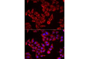 Immunofluorescence analysis of HeLa cells using SRGN antibody (ABIN5974179). (SRGN anticorps)