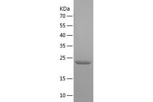 Western Blotting (WB) image for Chromosome 11 Open Reading Frame 73 (C11orf73) (AA 1-197) protein (His tag) (ABIN7122375)
