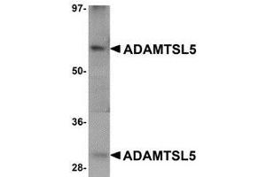 Western blot analysis of ADAMTSL5 in human skeletal muscle tissue lysate with AP30018PU-N ADAMTSL5 antibody at 1 μg/ml.