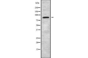 Western blot analysis of ARHGEF6 using K562 whole cell lysates (ARHGEF6 anticorps  (N-Term))