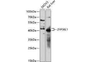 Western blot analysis of extracts of various cell lines, using ZFP36L1 antibody (ABIN7271431) at 1:3000 dilution.