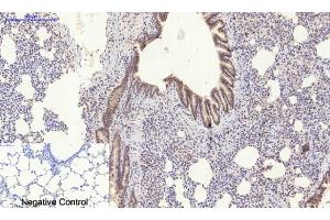 Immunohistochemical analysis of paraffin-embedded rat lung tissue. (STAT3 anticorps  (pSer727))