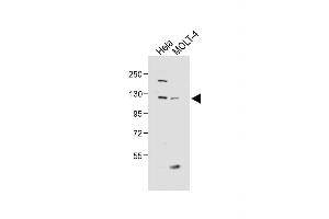 All lanes : Anti-SED Antibody (N-term) at 1:1000 dilution Lane 1: Hela whole cell lysate Lane 2: MOLT-4 whole cell lysate Lysates/proteins at 20 μg per lane. (SEMA6D anticorps  (N-Term))
