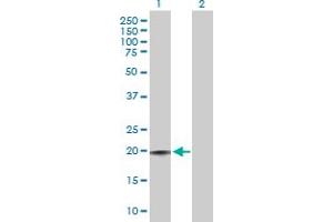 Western Blot analysis of CD3D expression in transfected 293T cell line by CD3D MaxPab polyclonal antibody.