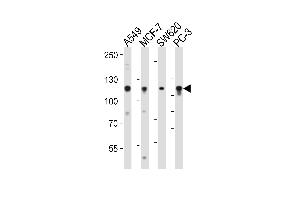 Western blot analysis of lysates from A549, MCF-7, SW620, PC-3 cell line (from left to right), using GAA Antibody at 1:1000 at each lane.