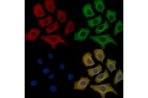 CD22 Mouse Monoclonal Antibody staining HepG2 cells by IF/ICC.