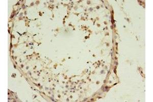 Immunohistochemistry of paraffin-embedded human testis tissue using ABIN7170098 at dilution of 1:100 (SLC13A4 anticorps  (AA 134-273))