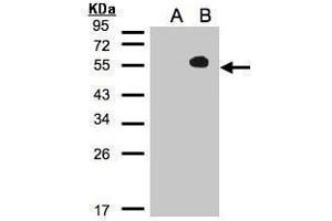 WB Image Western Blot analysis of TAB1 expression in transfected 293T cell line by MAP3K7IP1 polyclonal antibody.