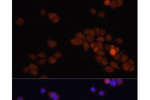 Immunofluorescence analysis of HT-29 cells using APC Polyclonal Antibody at dilution of 1:100. (APC anticorps)